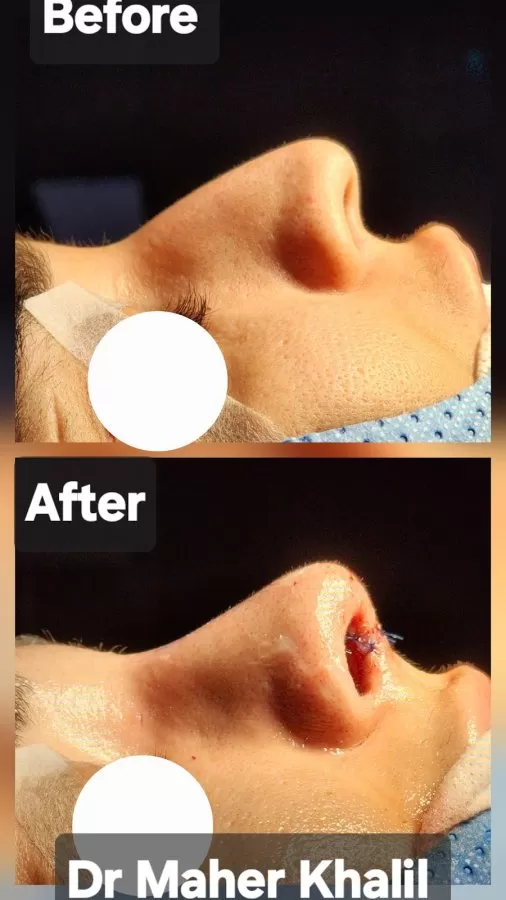 Dr. Maher Khalil German consultant. Best ENT Dubai - Photo 4