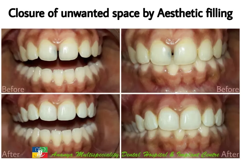 Ananya Multispeciality Dental Hospital and Implant Centre - Photo 3