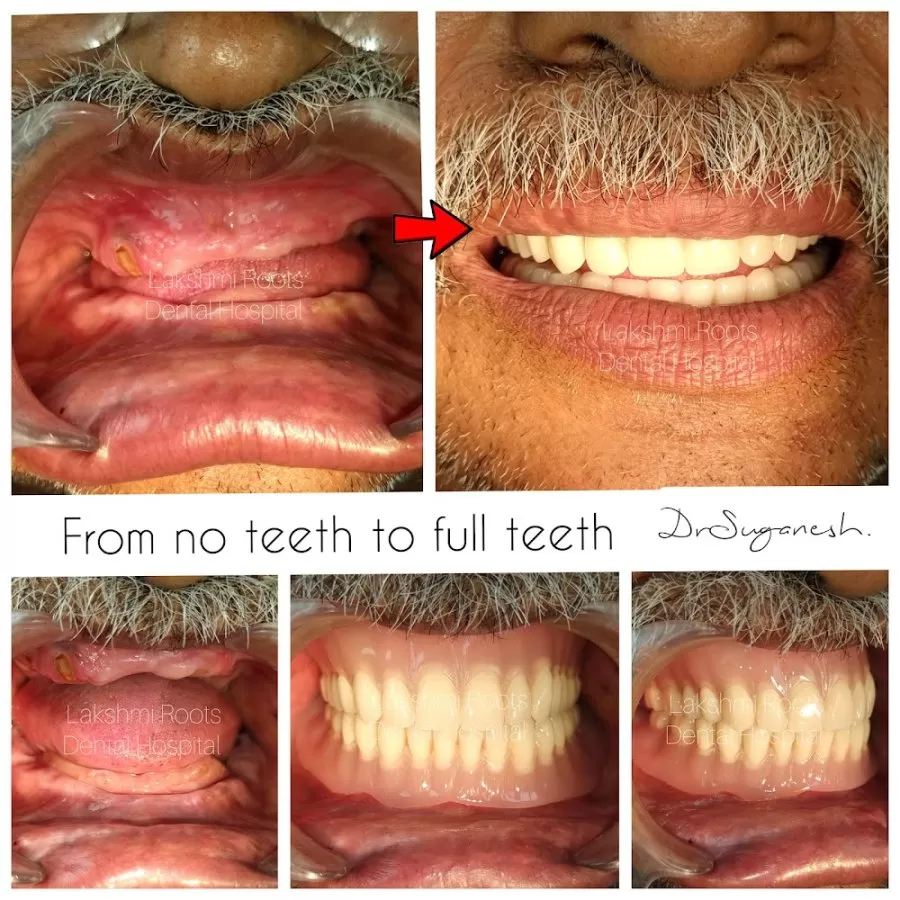 Lakshmi Roots Dental Hospital and Implant Centre- Dr Suganesh BEST DENTIST VILLIVAKKAM - Photo 6