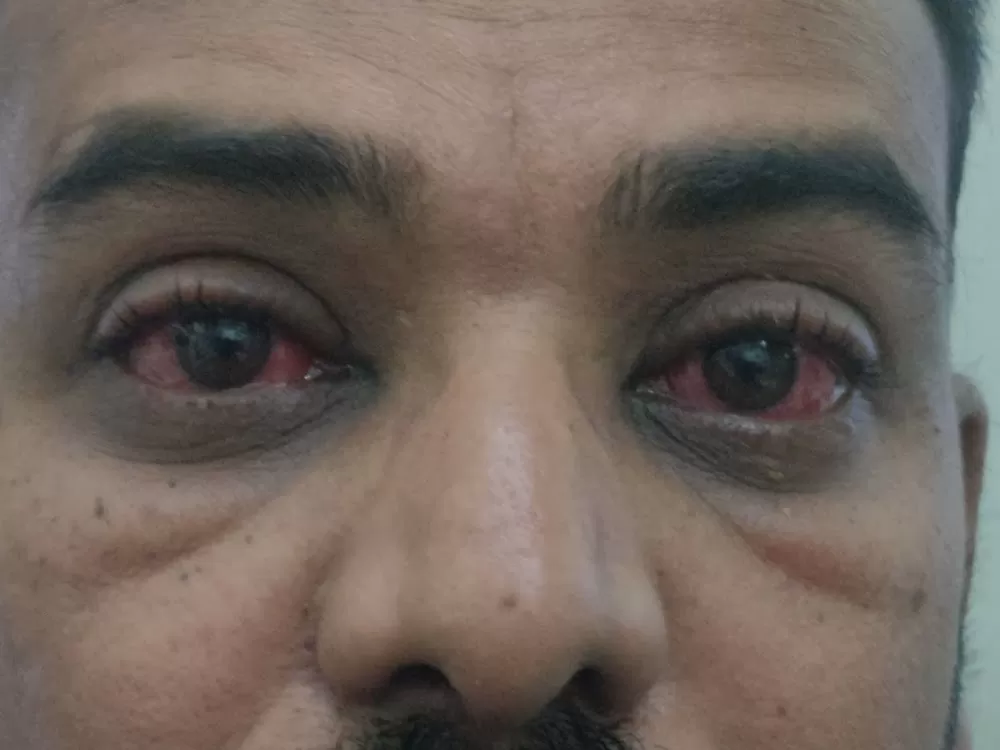 Mungale Eye Hospital - Photo 6