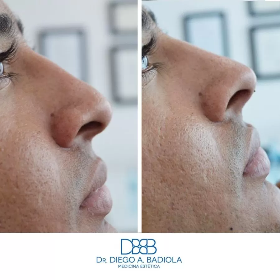 Clínica Dr. Badiola - Medicina Estética - Photo 6