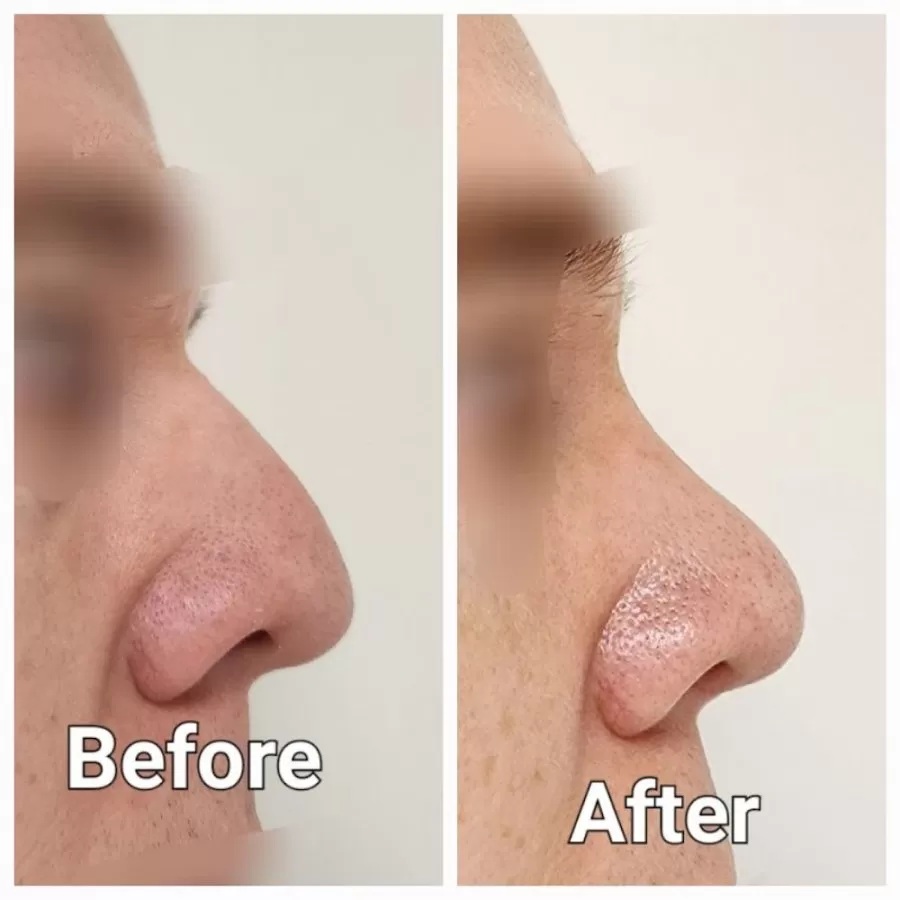 Dr. Maher Khalil German consultant. Best ENT Dubai - Photo 5