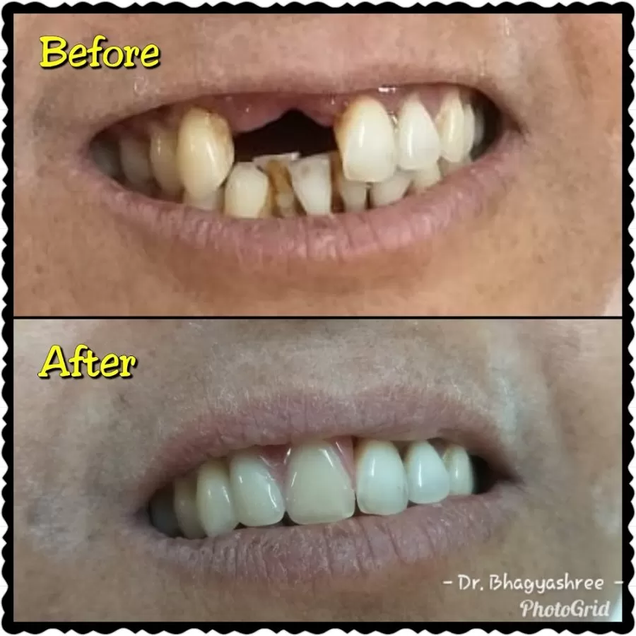 Dental Hub Clinic - Dr.Bhagyashree Mahale - Photo 3