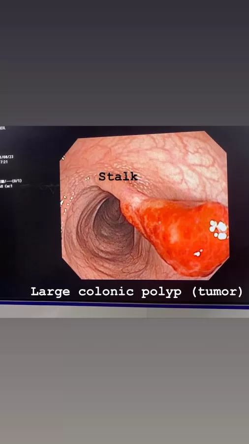 Dr. Neil Palkhiwala MD DM MRCP - Interventional Gastro and Hepatologist - Photo 8