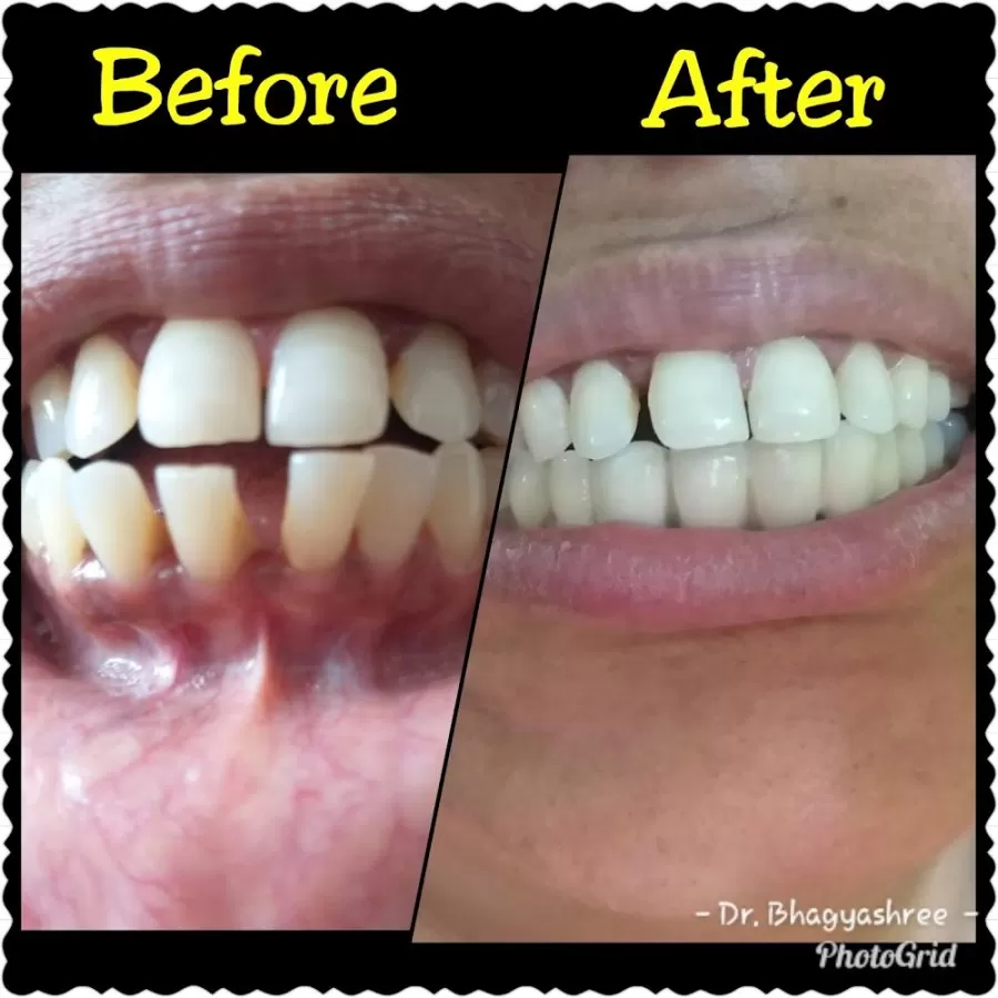 Dental Hub Clinic - Dr.Bhagyashree Mahale - Photo 4