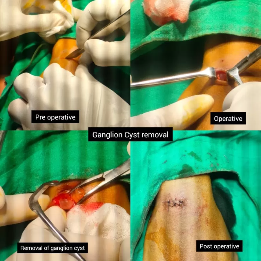 Varad Piles & Proctology Surgical Unit | Dr.Ramesh ahire MS (Shalya) General Surgeon & Proctologist | Nashik - Photo 5