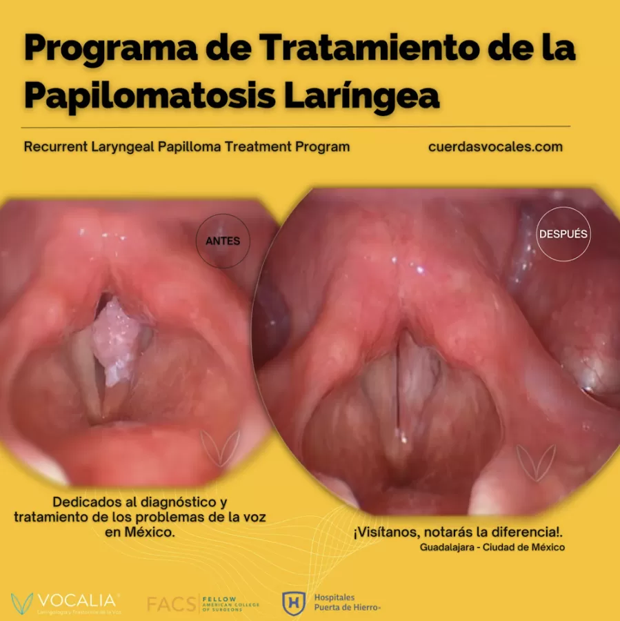 Vocalia Otorrinolaringólogos ® Oídos, Nariz y Garganta, Laringología y Trastornos de la Voz - Dr. Gerardo López Guerra - Photo 6