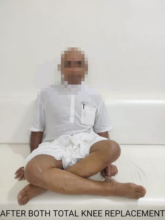 𝗧𝗮𝘁𝘀𝗮𝘁 𝗢𝗿𝘁𝗵𝗼𝗽𝗲𝗮𝗱𝗶𝗰 𝗦𝗽𝗲𝗰𝗶𝗮𝗹𝗶𝘁𝘆 𝗛𝗼𝘀𝗽𝗶𝘁𝗮𝗹 - Joint Replacement Hospital in Satelitte Ahmedabad - Photo 3