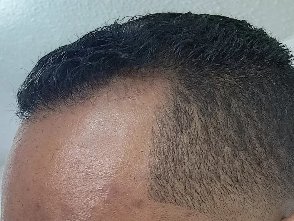 Hair Transplant Institute - Dra. Alba Reyes Sagiv - Photo 4