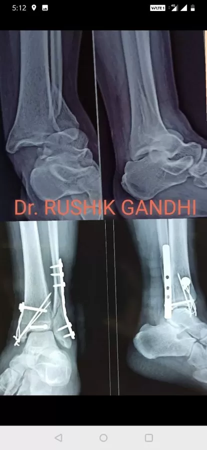 MUNIKRUPA ORTHOPAEDIC AND ENT HOSPITAL - Photo 7