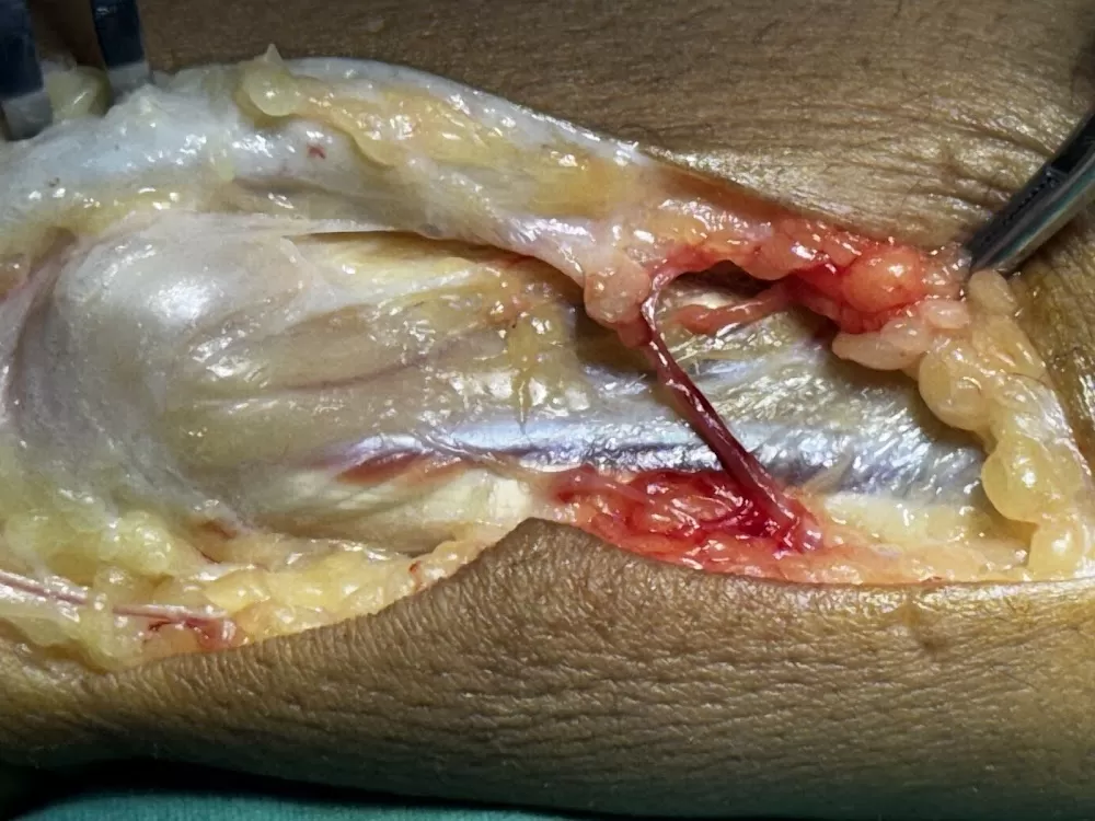 Hand Surgeon Dr Gaurav Pagare - Photo 6