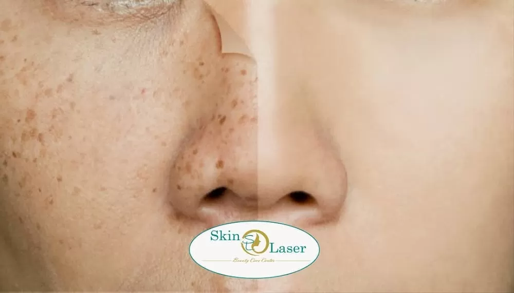 Centre Skin Laser - Photo 3