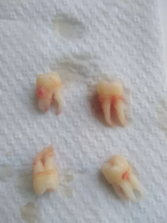 Dental universal - Photo 7