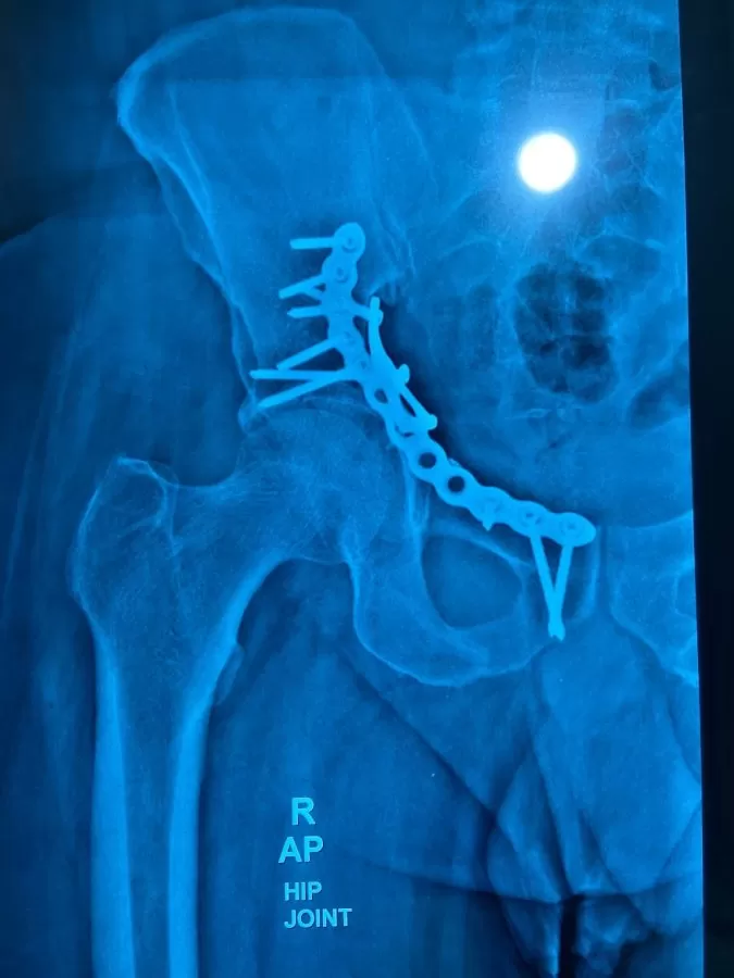 Shreeji Orthopaedic & ENT Hospital - Photo 6