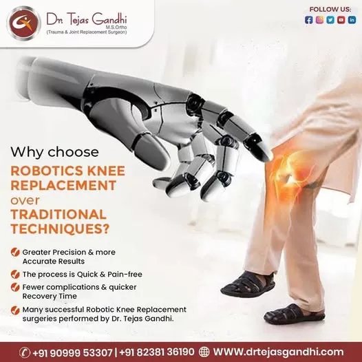 Arihant Knee Replacement Hospital –Hip Replacement Surgeon Ahmedabad,Gujarat |Ligament Surgery|Total Knee Replacement Surgery - Photo 6
