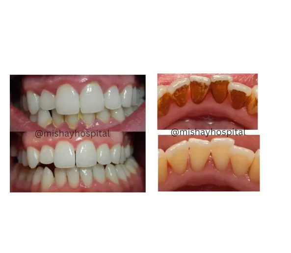 Mishay dental - Photo 6