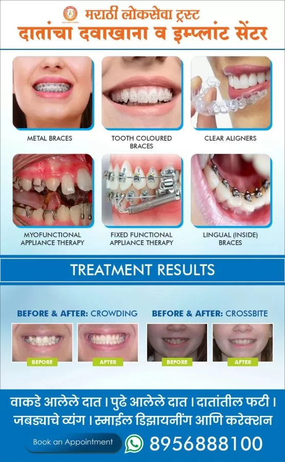 MARATHI LOKSEVA TRUST - CITY DENTAL CLINIC - Photo 6
