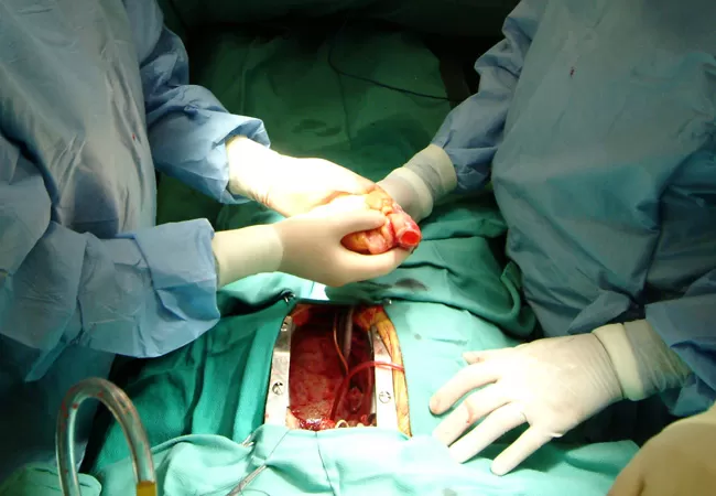 DR CHANDRA KUAMR SINGH - Cardiologist in Bhopal | Heart Specialist in Bhopal | Angioplasty | Angiography - Photo 2