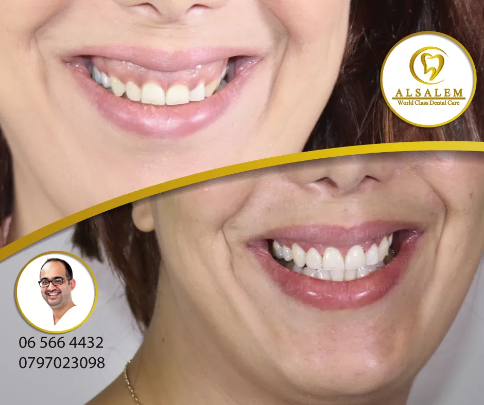 Alsalem Dental & Implant Center - Photo 8