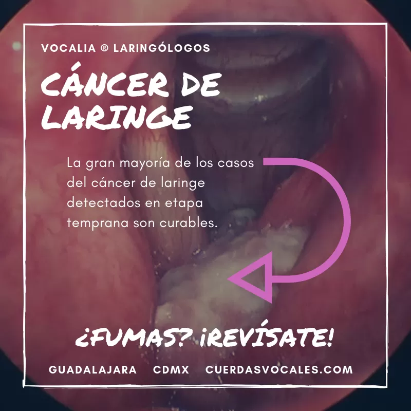 Vocalia Otorrinolaringólogos ® Oídos, Nariz y Garganta, Laringología y Trastornos de la Voz - Dr. Gerardo López Guerra - Photo 7