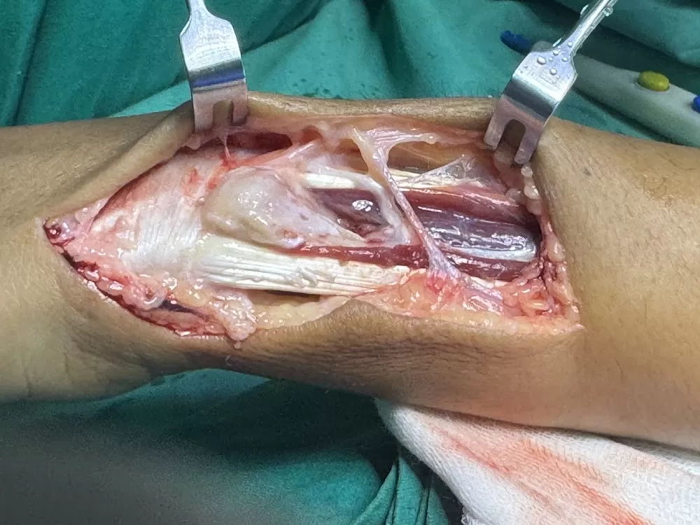 Hand Surgeon Dr Gaurav Pagare - Photo 2