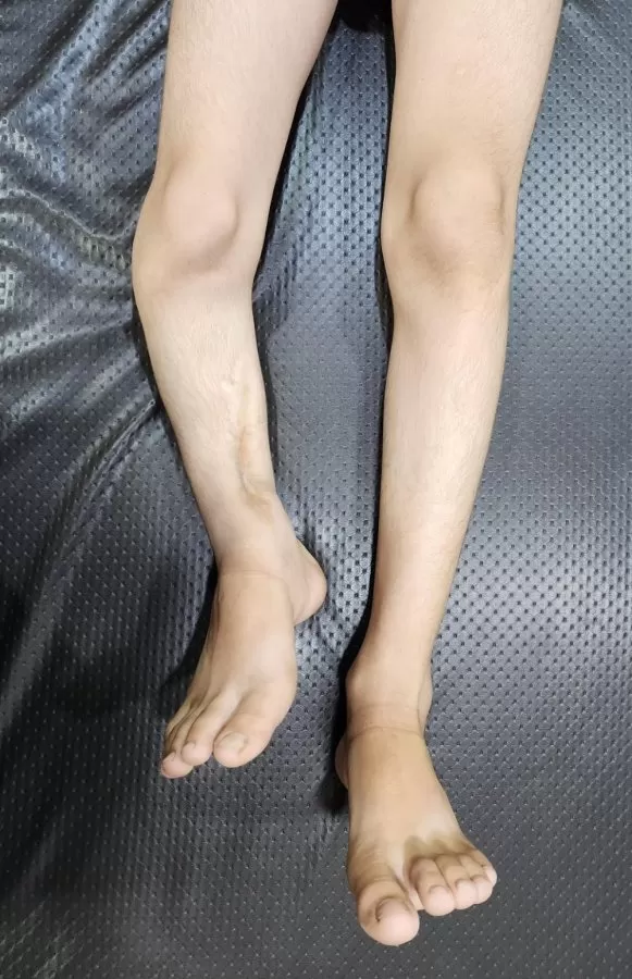 Dr Sudhanshu Bansal (CODS Clinic) : Paediatric Orthopaedic Surgeon in Ludhiana - Photo 2
