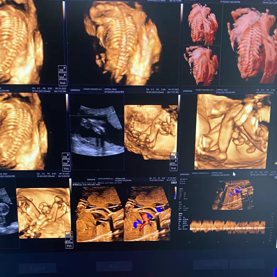 Parikh’s Women’s & Surgical Hospital - Dr Khyati Parikh - Gynecologist Infertility specialist and laparoscopic surgeon - Photo 4