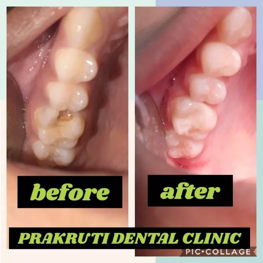 Prakruti Dental Clinic - Photo 6