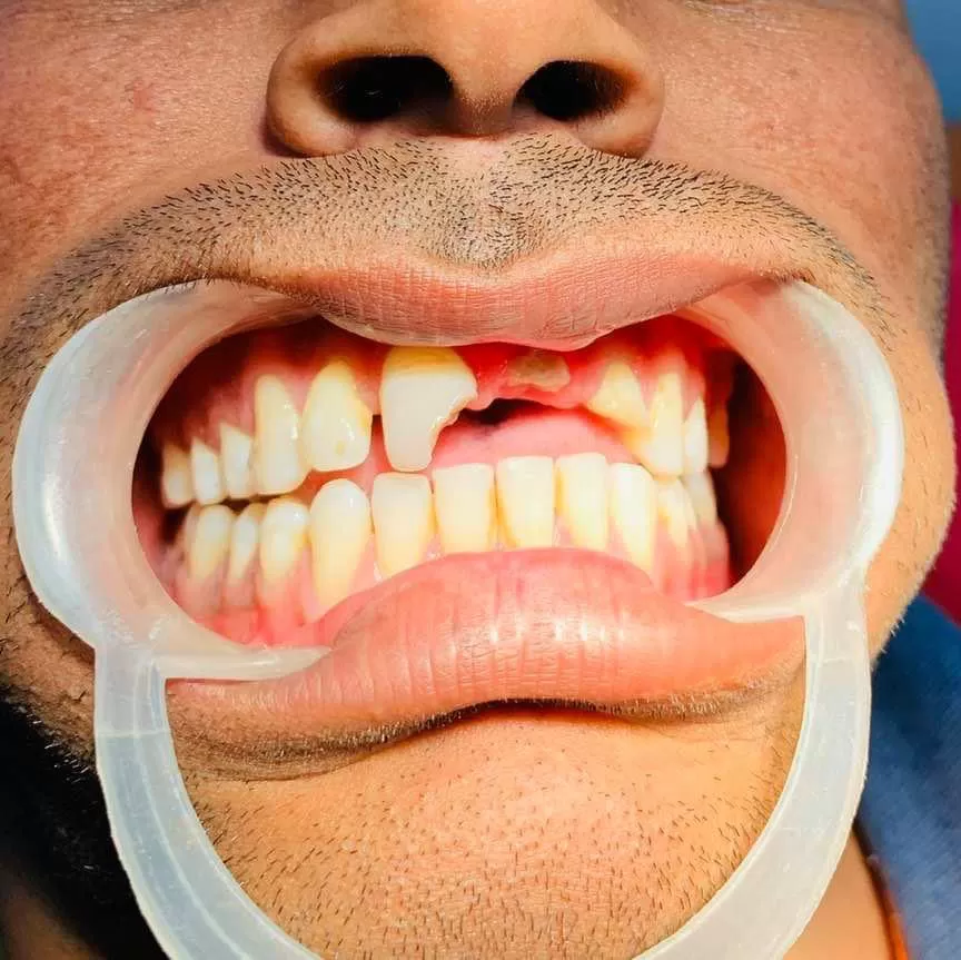 Dr Somendra Dental Clinic And Implant Center Government empanelled RGHS,CGHS,ECHS,JVVNL,NBC,AYUSHMAN CAPF - Photo 1