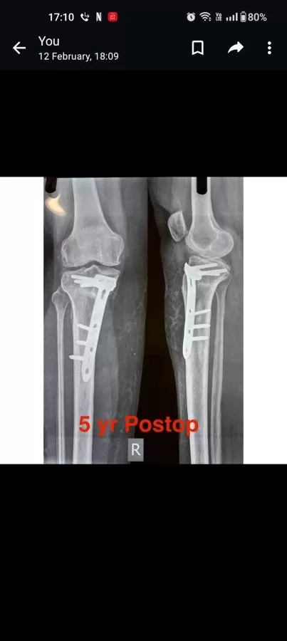 Sattva Orthopaedic and ENT Hospital - Photo 4
