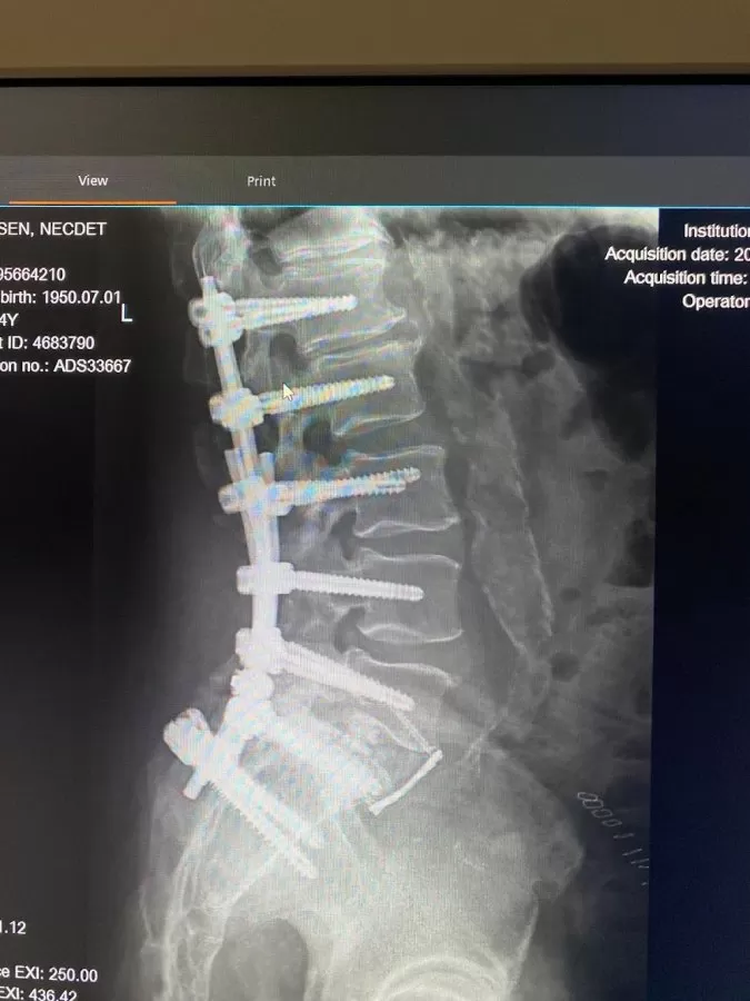 orthopedic surgery, spine surgery - Photo 5