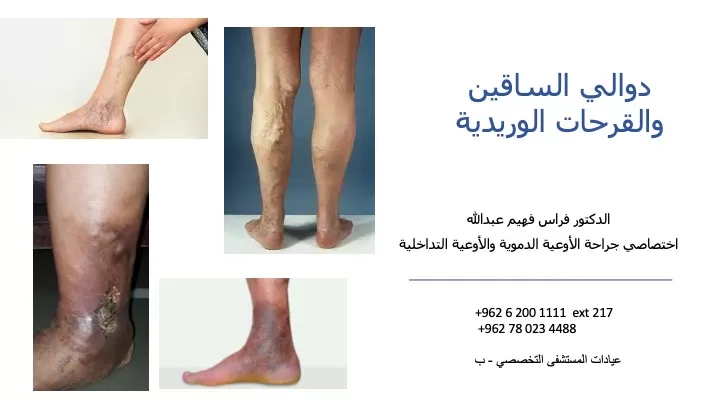 Dr. Feras Fahim Abdullah – Vascular Surgery - Photo 3