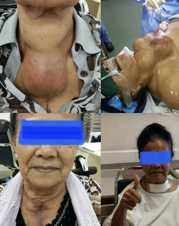 Dr. Jonathan Deong Kee Kong, ENT (Ear, Nose & Throat) Specialist and Head & Neck Surgeon - Photo 3