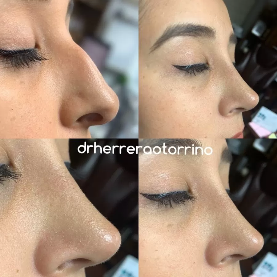drherreraotorrino - Photo 4