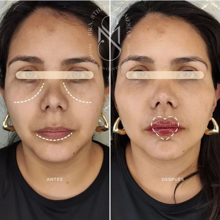 Dra. Sthefanny Mesias | Medicina Estética Avanzada y Rejuvenecimiento Facial - Photo 4