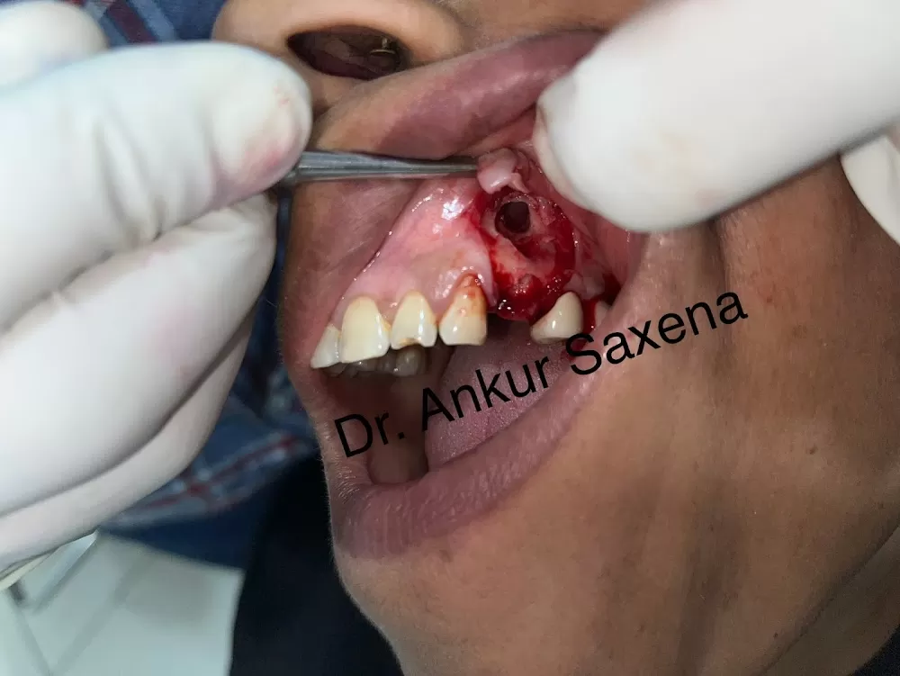 Noida Dental Hospital - Dental clinic | Dentist in Greater Noida - Photo 4