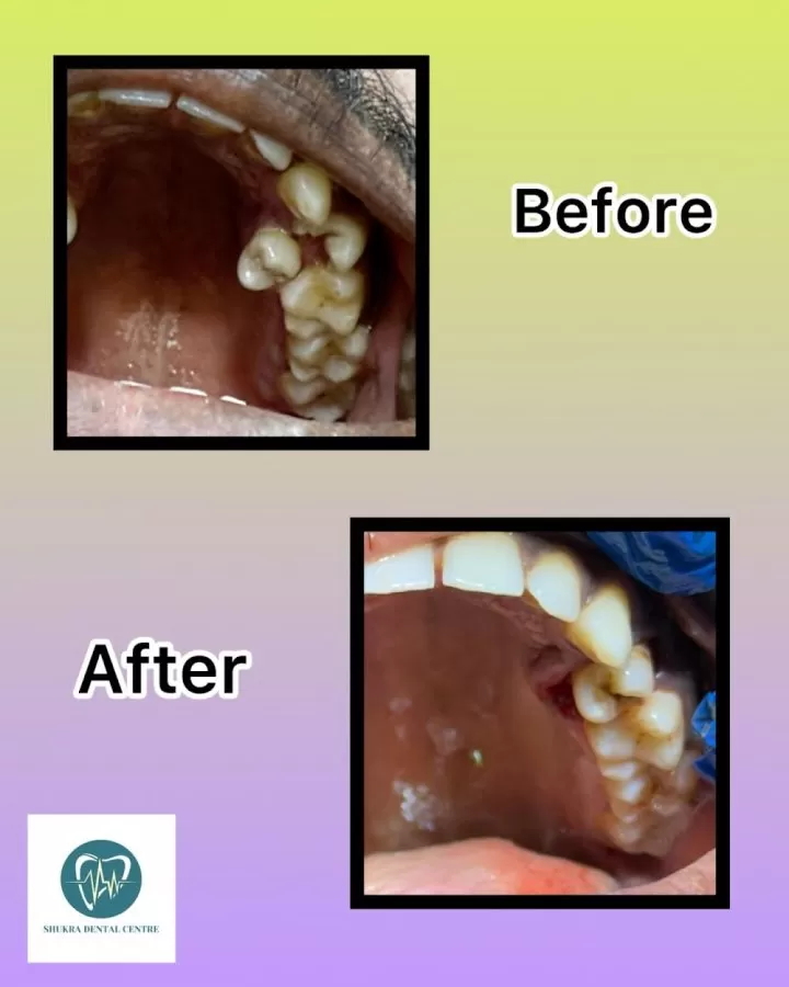 Shukra Dental Centre Mint - Photo 6