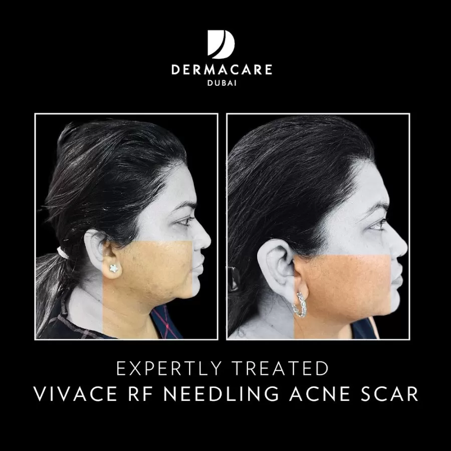 DERMACARE DUBAI - Photo 6