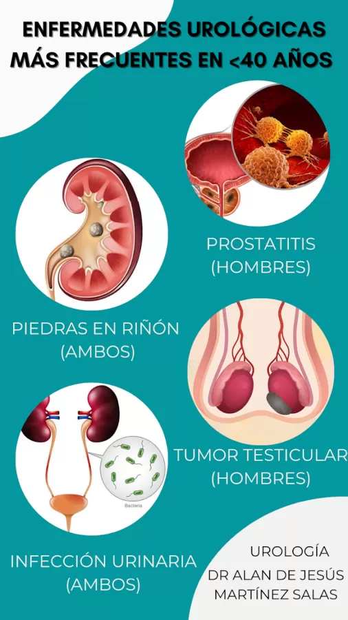 Urólogo- Dr Alan de Jesús Martínez Salas - Photo 5