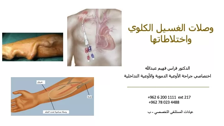 Dr. Feras Fahim Abdullah – Vascular Surgery - Photo 4