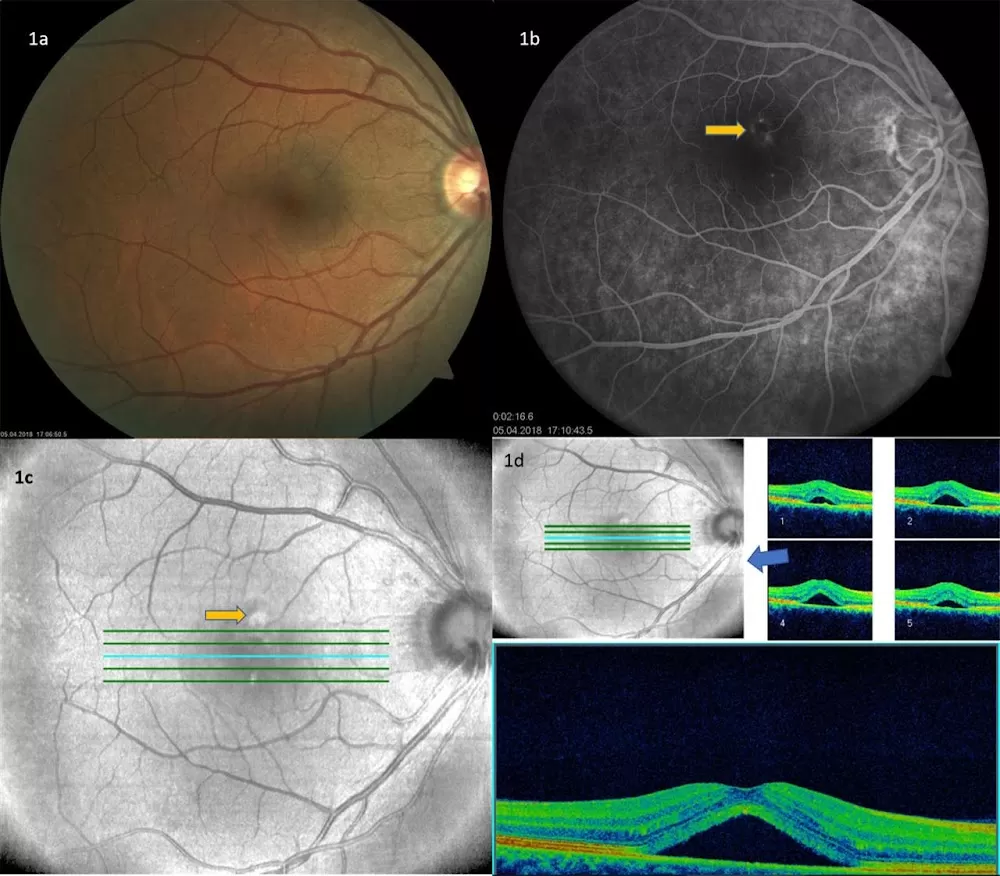 Sudhalkar Eye Hospital and Retina Centre - Photo 3