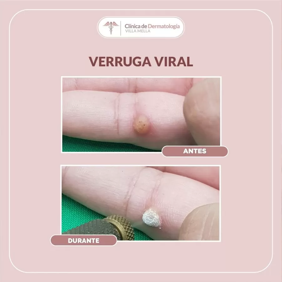 Clínica de Dermatología Villa Mella - Photo 3