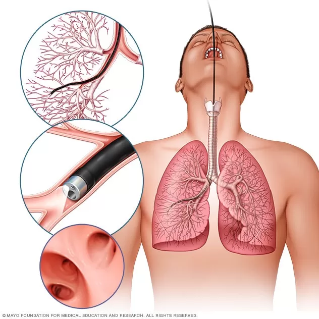 Dr. Dharit Shah - PULMONOLOGIST & ALLERGY SPECIALIST - Photo 8
