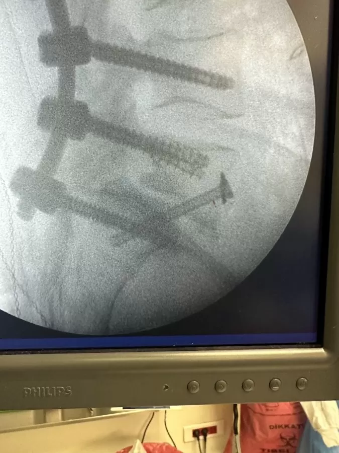 orthopedic surgery, spine surgery - Photo 6