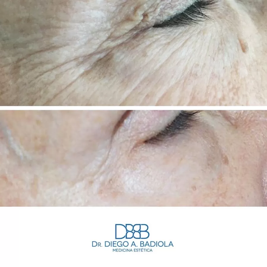 Clínica Dr. Badiola - Medicina Estética - Photo 8