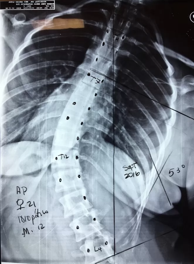 Unidad de Columna Vertebral Dr. Julio Angel García. Diagnóstico y Tratamiento. Centro Médico Dominicano - Photo 8