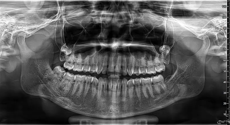Smile Dental Hospital - Photo 5