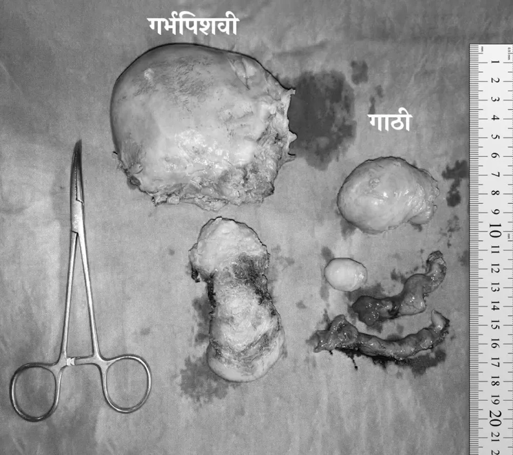 Bhadane Maternity Hospital - Photo 7