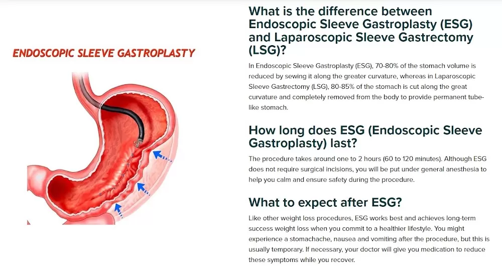 Gallstones, Hernias, Reflux, Gastric Cancer, Weight Loss Surgery & Endoscopy - Dr Toh Bin Chet Resurgence Surgical Clinic - Photo 4