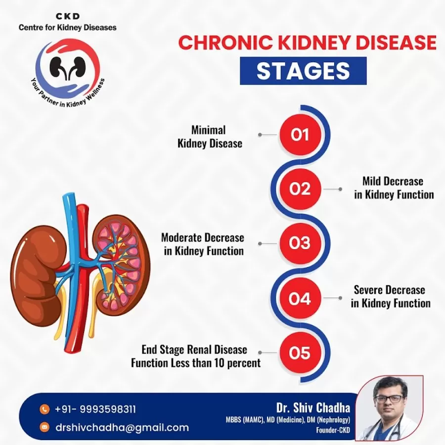 Dr. Shiv Chadha – Best Nephrologist | Kidney Transplant | Hemodialysis Centre | Chronic Kidney Disease Care in Delhi NCR - Photo 3